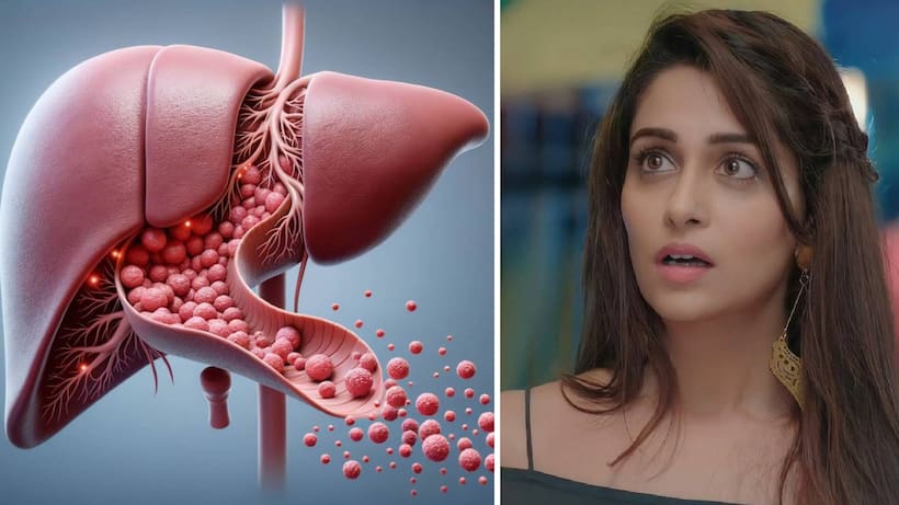 Dipika kakkar diagnosed with non cancerous liver tumor 