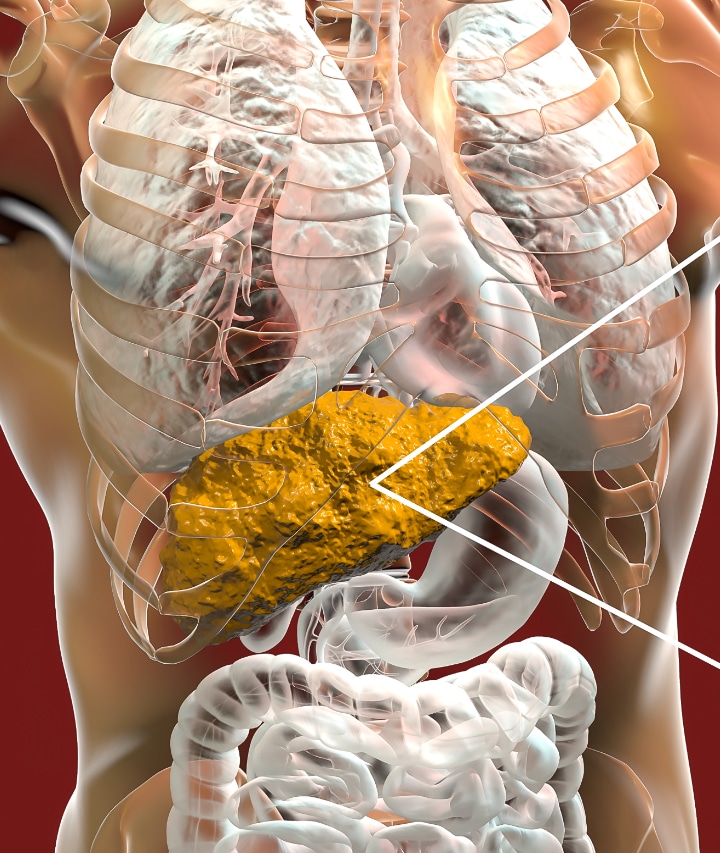 What are the symptoms of fatty liver disease