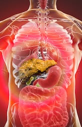 early signs of liver cirrhosis 
