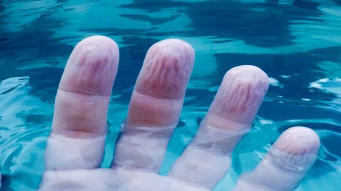 Wrinkled fingers