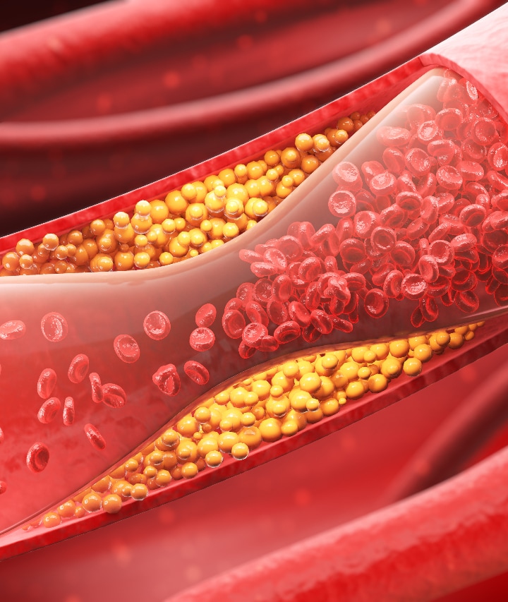 having these foods daily can increase cholesterol