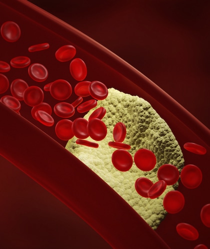  HDL cholesterol: మంచి కొలెస్ట్రాల్ పెరగాలంటే.. ఈ మార్పులు చేయండి!