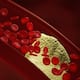avoid these foods if you have high cholesterol levels