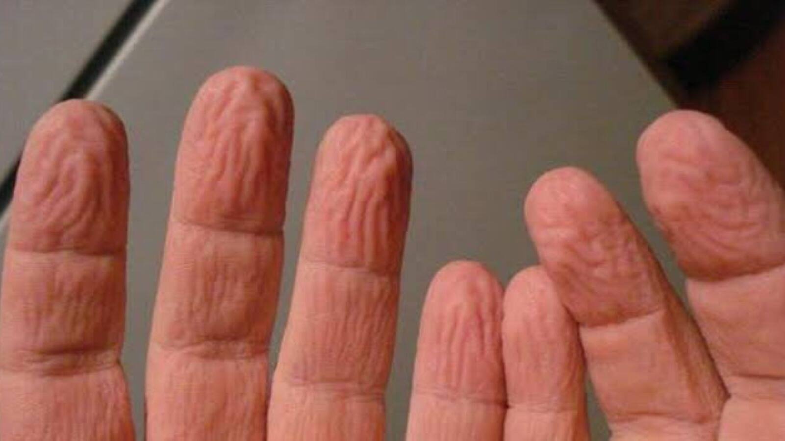 fingers wrinkle