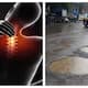Chronic neck and back pain due to road; Young man wants Bengaluru Municipal Corporation to pay Rs 50 lakh compensation