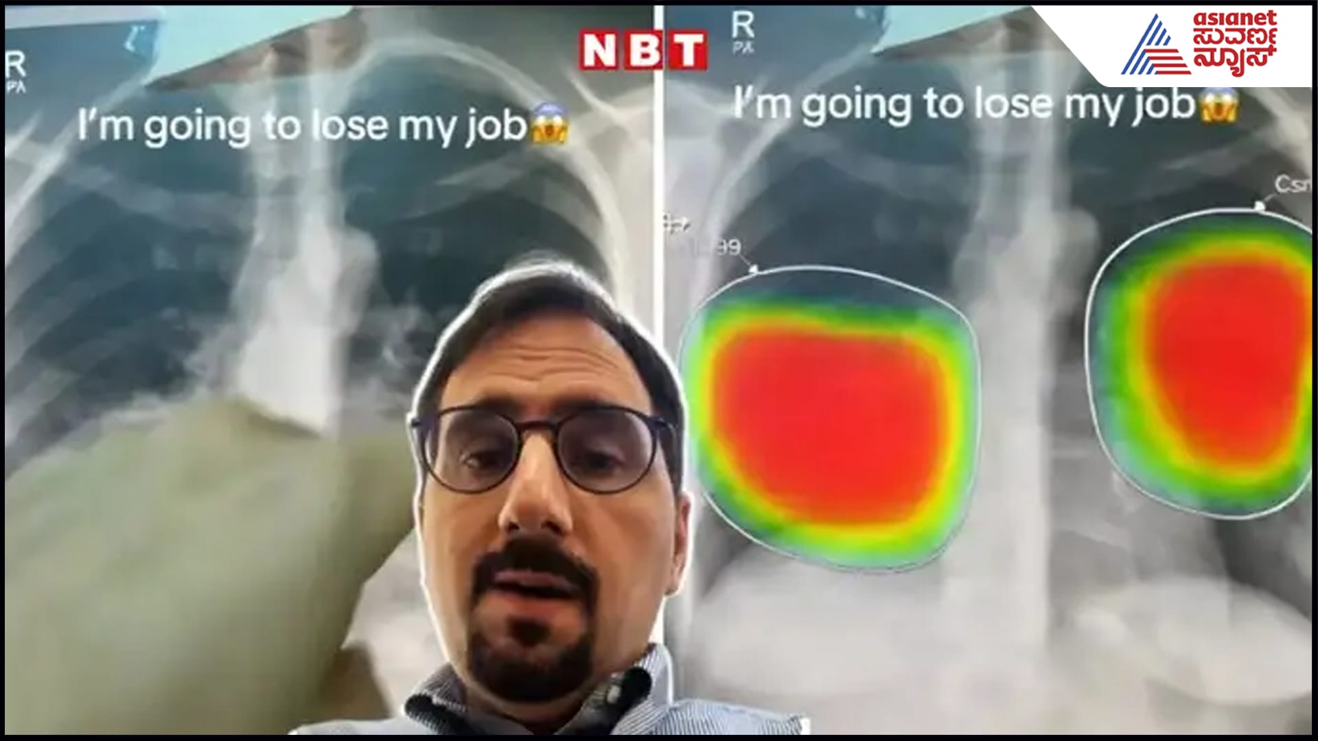 doctor says he lose his job as AI analyses X ray in seconds