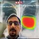 doctor says he lose his job as AI analyses X ray in seconds