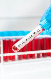 Foods That Increase Uric Acid Levels san