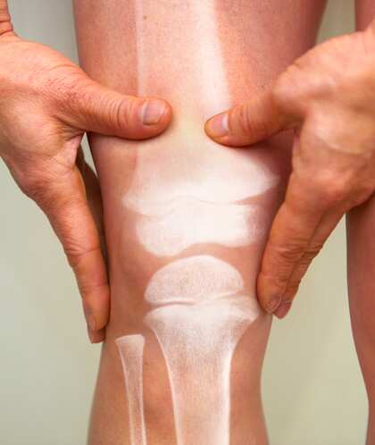  Osteoporosis: ఈ లక్షణాలు కనిపిస్తున్నాయా? మీలో ఆ లోపం ఉన్నట్లే..  