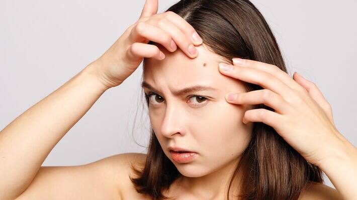personality traits mole on forehead