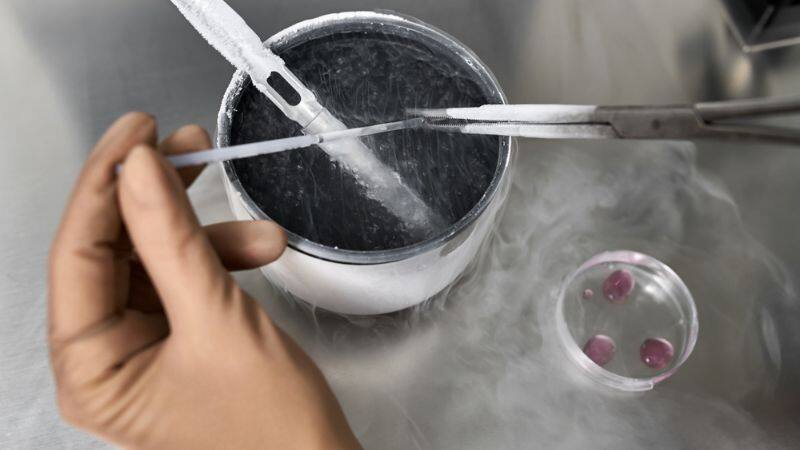  Egg freezing 