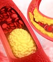 Health Tips: ఈ సూపర్ ఫుడ్స్ తింటే.. చెడు కొలెస్ట్రాల్ ఇట్టే తగ్గుతుందట