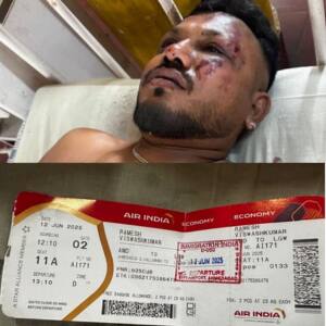 Air India crash in Ahmedabad - అహ్మదాబాద్ విమాన ప్రమాదంలో ప్రాణాలతో బయటపడ్డ ఒకేఒక్కడు