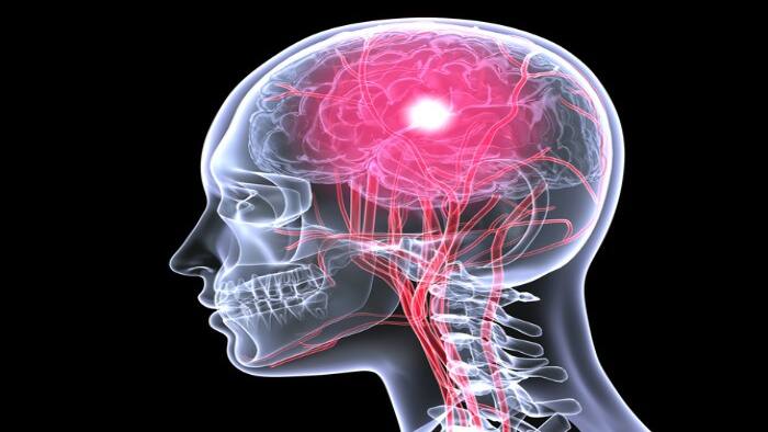 Brain scan