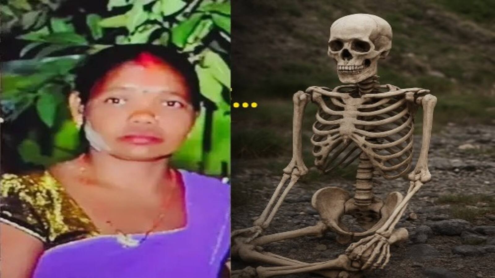 Bihar Skeleton Case