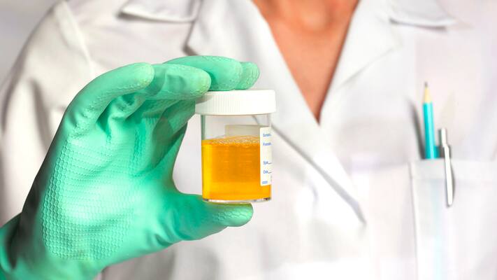 Scientists find a surprising use for urine
