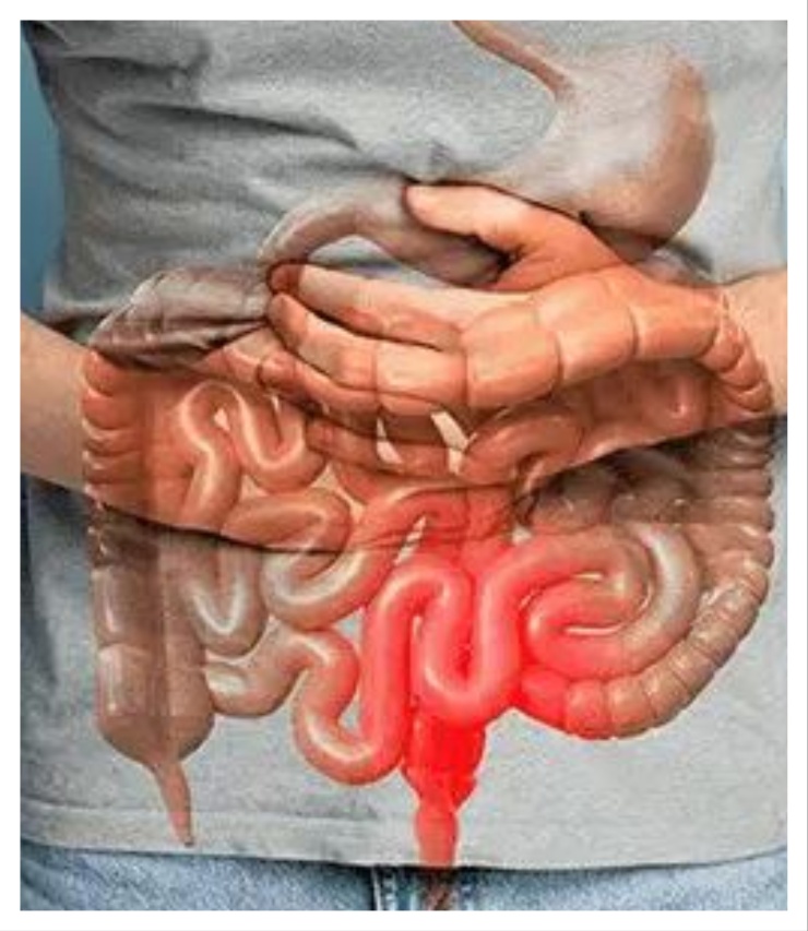 foods to eat to prevent constipation