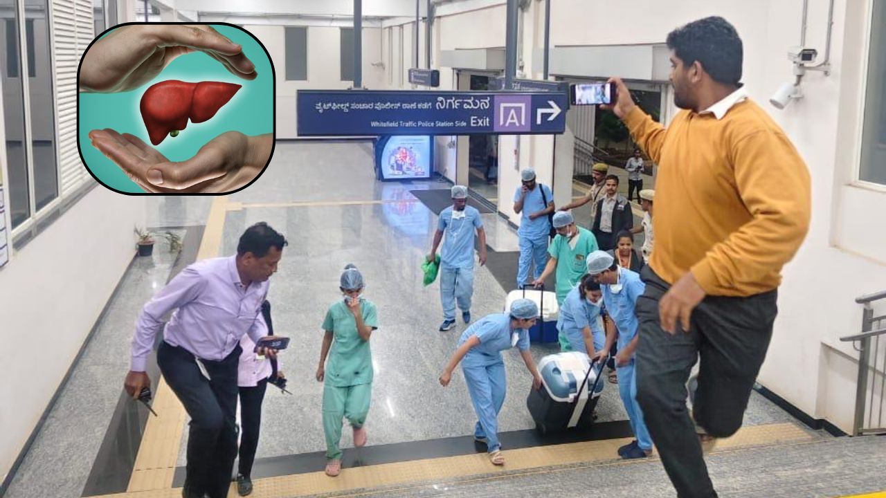 Bengaluru Namma Metro Liver transportation Bengaluru Namma Metro Liver transportation