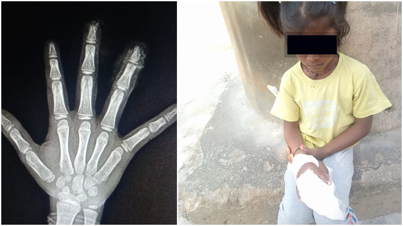 Tumakuru school negligence case