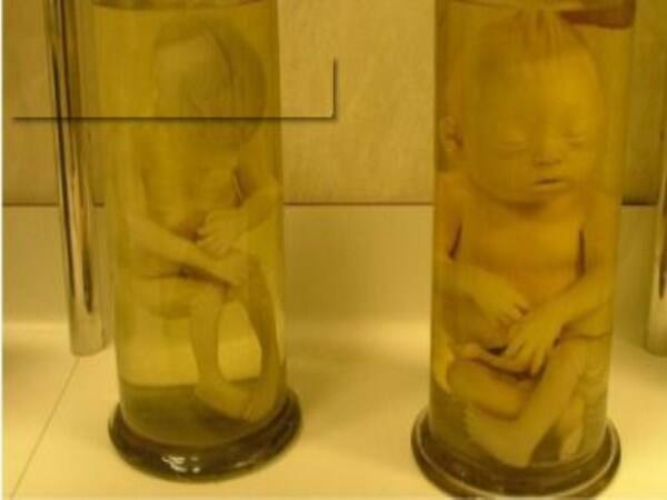 kids dumped in bottle in japan 