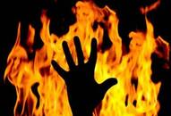 Telangana: Two Class 10 boys fall for the same girl, set each other on fire