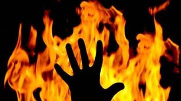 Telangana: Two Class 10 boys fall for the same girl, set each other on fire