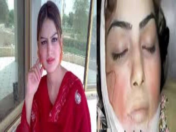 Lady singer shot dead in pakistan