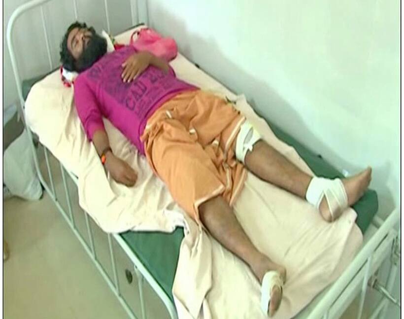 Thrissur: RSS activists hack Yuva Morcha leader for Facebook posts criticising BJP [Video]