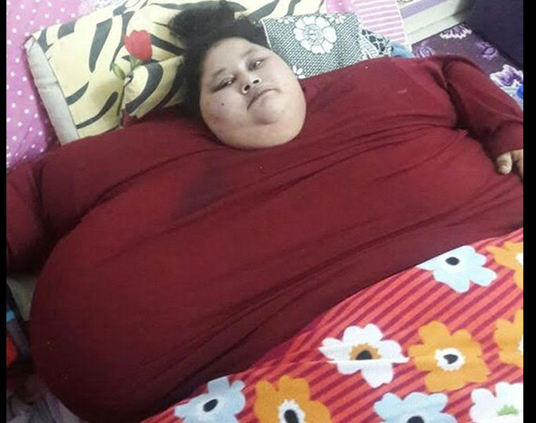 how to bring 500 kg woman to Mumbai for weightloss surgery