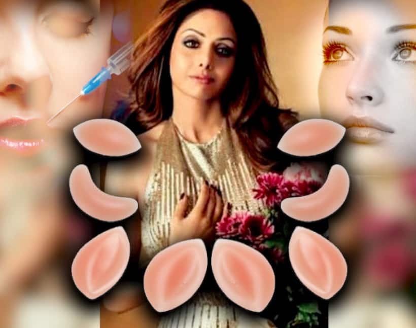 Are cosmetic surgeries done on Sridevi, the reason for her death?