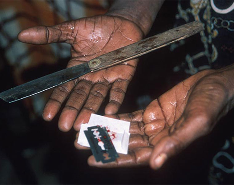 Female genital mutilation widespread agents available online tvm