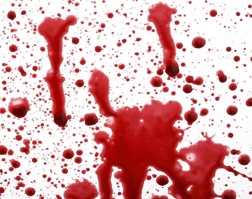 Protesting UP home guards write bloody letter to PM