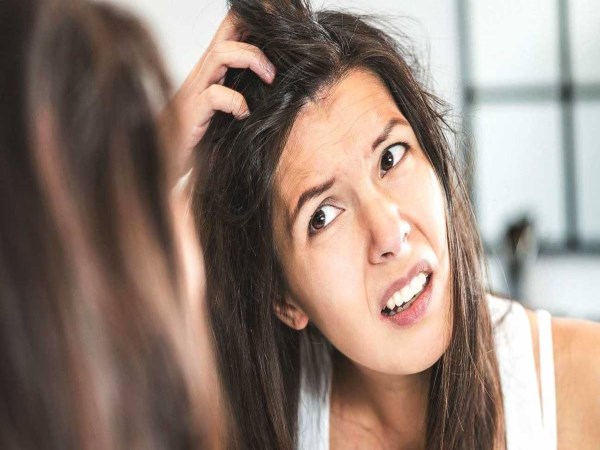 Home Remedies to Get Rid of Dandruff Naturally