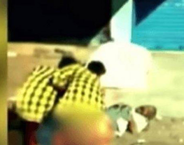 Drunk Miscreants Burn Private Parts Of Man Sleeping On The Roadside