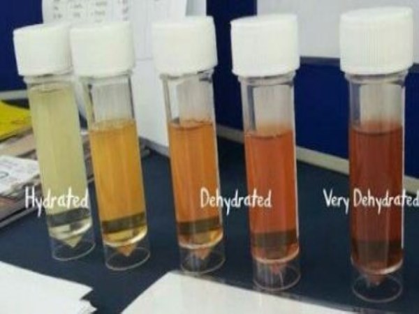 colour of the urine is indicates  the problem of urine 