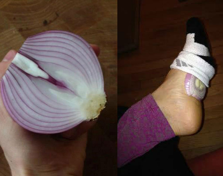 This is What Happens When You Put Cut Up Onions in Your Socks