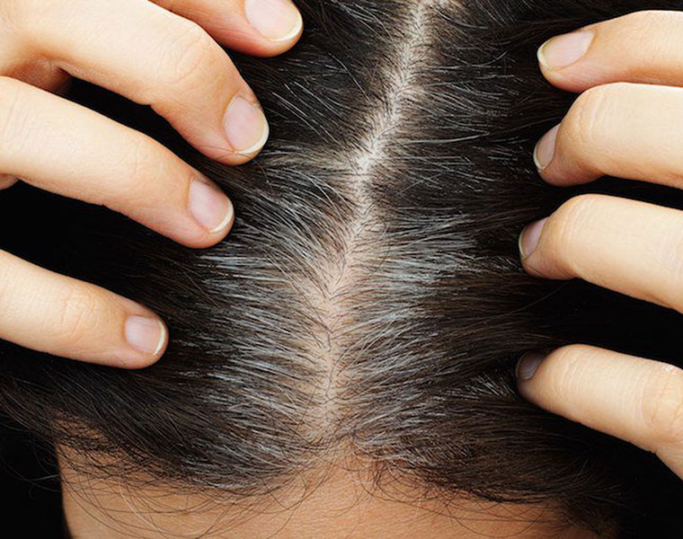 home remedies for treat gray hair at home