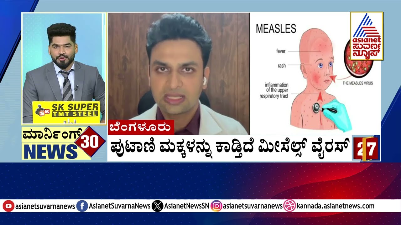 Measles Virus Outbreak Affecting Children