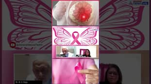 Curable Cancer Stages: Dr. M A Raja Explains #breastcancer #cancer