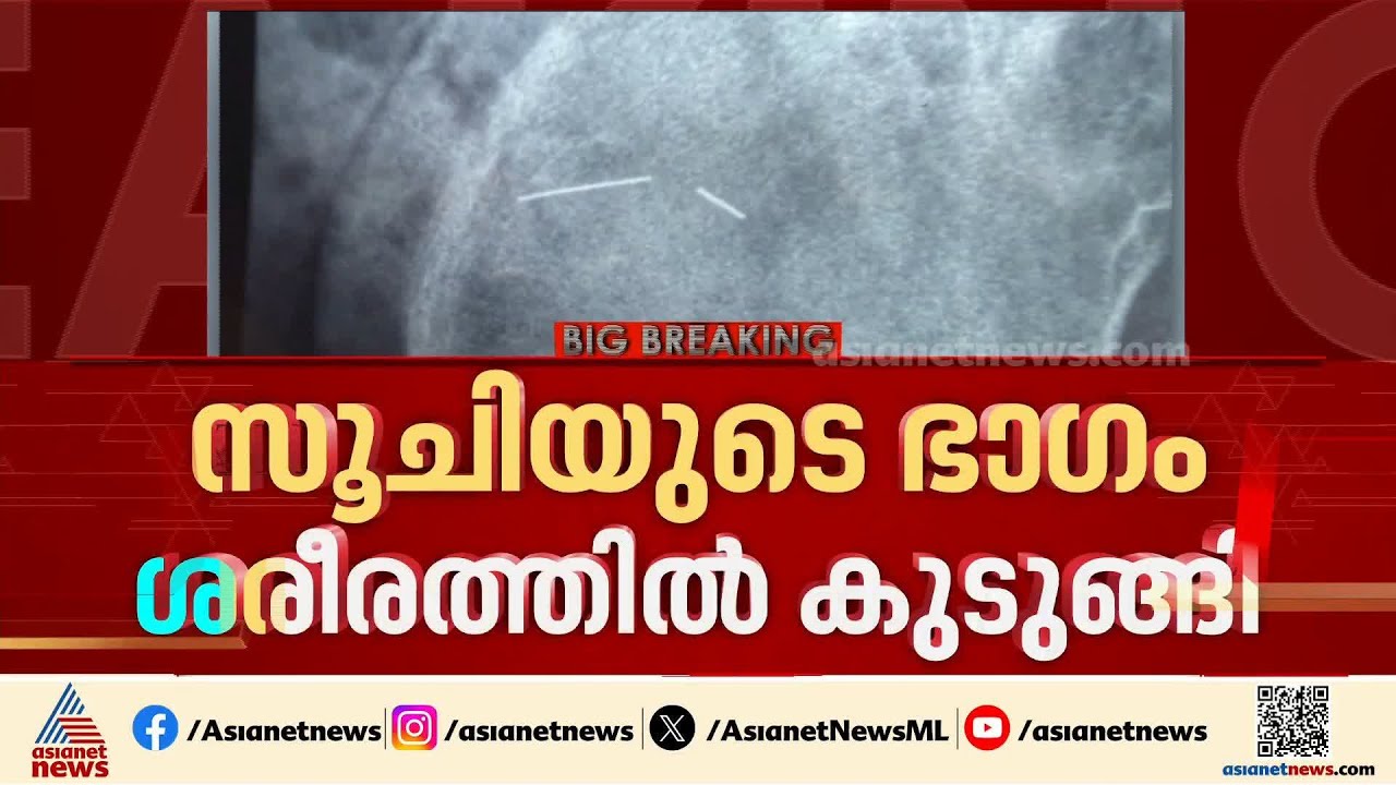 സൂചിയുടെ ഭാഗം ശരീരത്തിൽ കുടുങ്ങി; ആശുപത്രിക്കെതിരെ ചികിത്സാ പിഴവ് ആരോപിച്ച് വീട്ടമ്മ| Kozhencherry