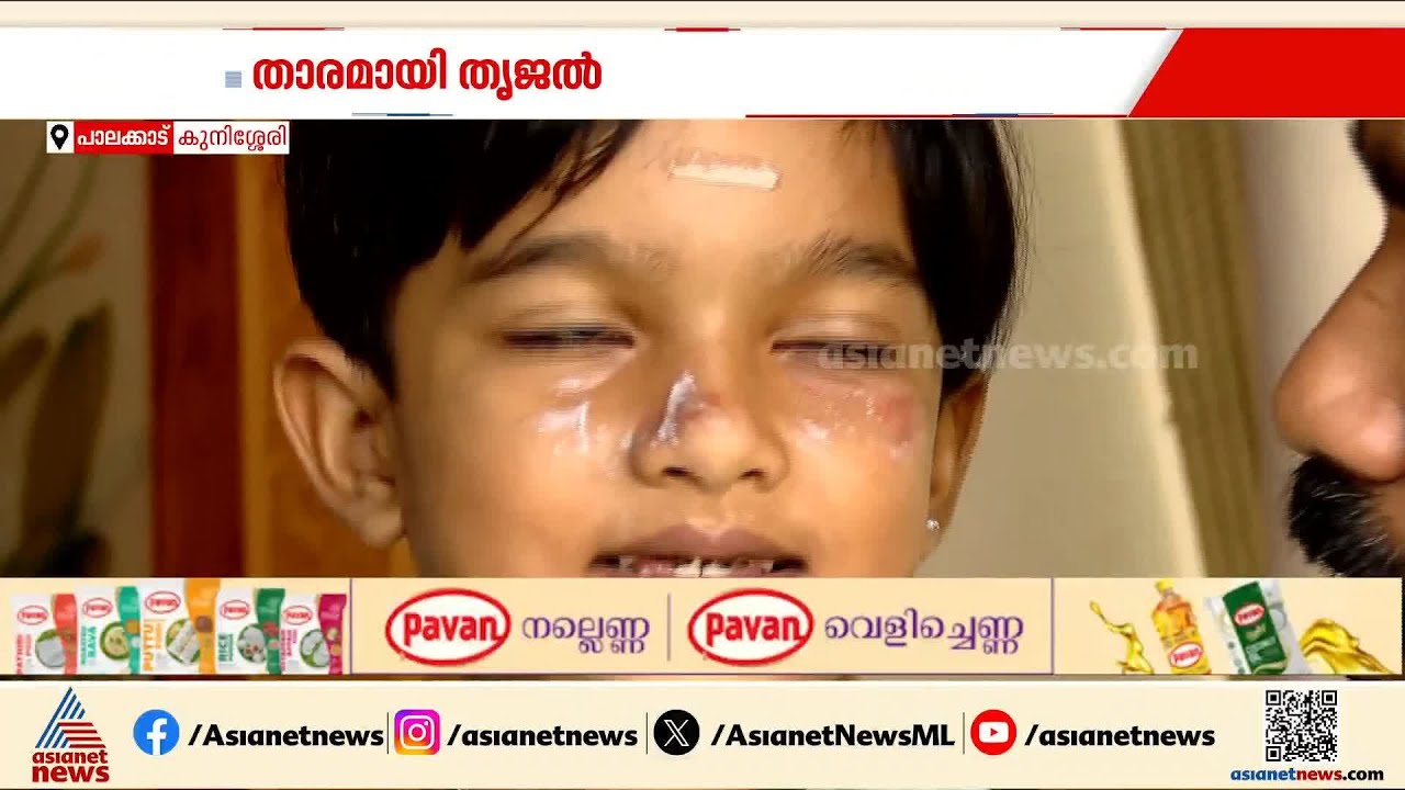 വെയിലേറ്റ് വാടില്ല... സൂര്യാതപമേറ്റ് മുഖം പൊള്ളി, പിന്നാലെ ബോധവൽക്കരണവുമായി തൃജൽ