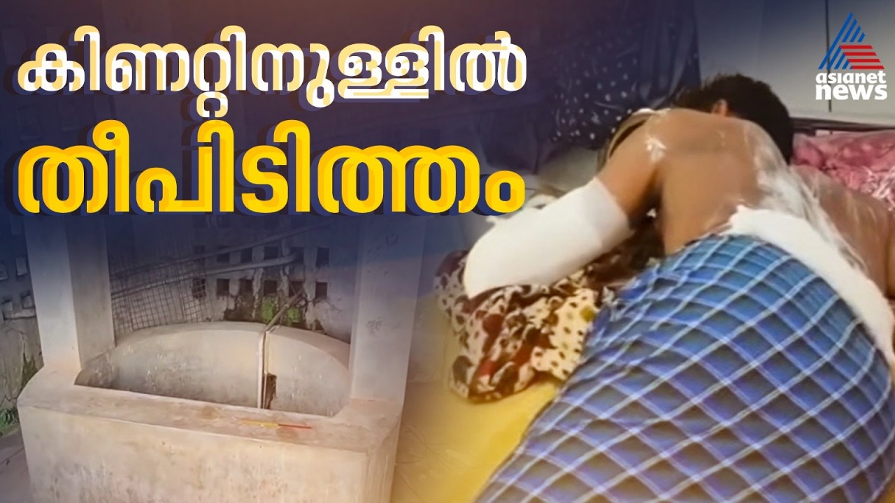 തിരുവനന്തപുരത്ത് കിണറ്റിനുള്ളിൽ അഗ്നിബാധ; മൂന്ന് യുവാക്കൾക്ക് പൊള്ളലേറ്റു
