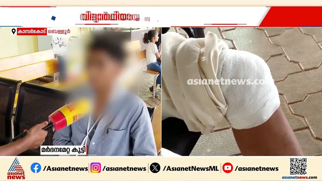 ഷർട്ടിന്റെ ബട്ടൺ ഇട്ടില്ല; പ്ലസ് വൺ വിദ്യാർത്ഥിക്ക് സീനിയർ വിദ്യാർത്ഥികളുടെ മർദനം | kasaragod