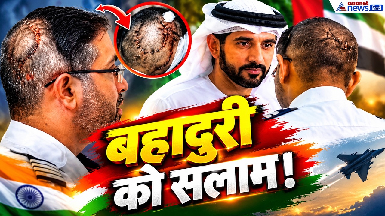 Smit Machhar: सिर में टांके ही टांके! स्मित मच्छार को देखते ही UAE के राष्ट्रपति ने क्यों लगाया गले?