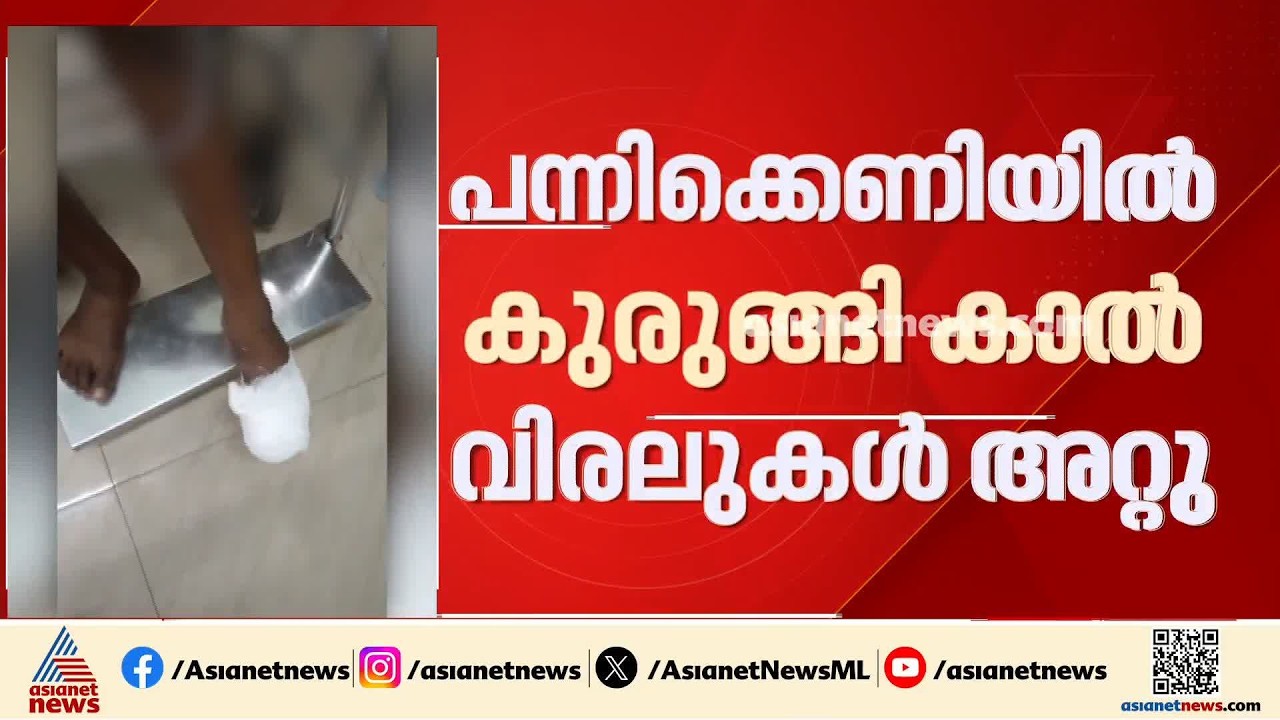 സ്വകാര്യ വ്യക്തി വച്ച പന്നികെണിയിൽ കുരുങ്ങി; ഒമ്പതാം ക്ലാസുകാരൻറെ കാൽ വിരലുകൾ അറ്റു | Boar trap