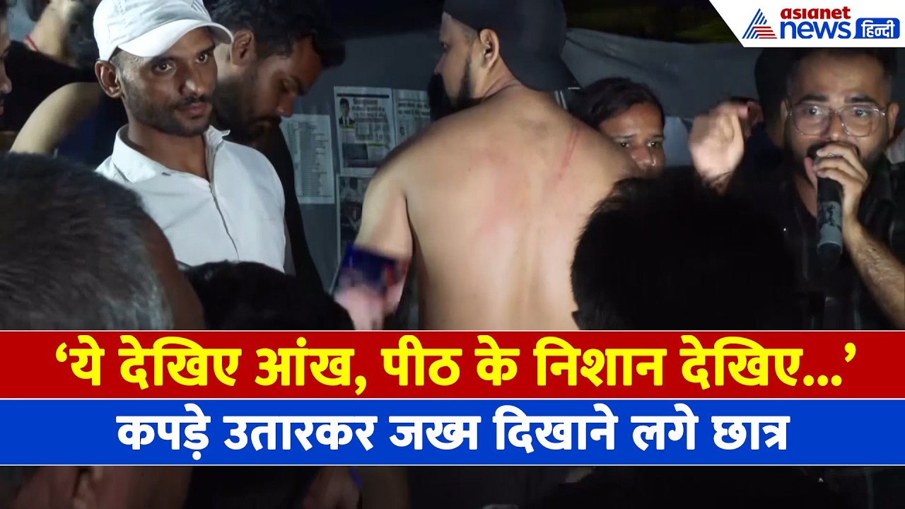 JPSC Protest: 'घेरकर मारा, अचानक से टूट पड़ी पुलिस', कपड़े उतारकर छात्रों ने दिखाया भयंकर जख्म