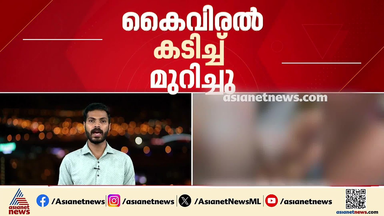 കൊച്ചിയിൽ രണ്ടിടത്തായി കെെവിരൽ കടിച്ചുമുറിച്ച് ആക്രമണം | Kochi | Crime