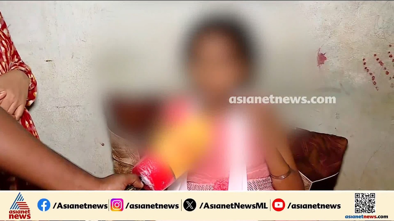 മലപ്പുറത്ത് അധ്യാപകന്റെ മർദ്ദനം; അഞ്ചാം ക്ലാസുകാരിയുടെ കൈയ്ക്ക് പൊട്ടൽ | Malappuram | MSM School